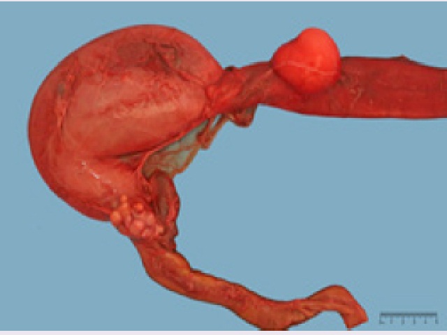 Juvenile Seal, Upper Gastrointestinal Tract; A Large Cyst was