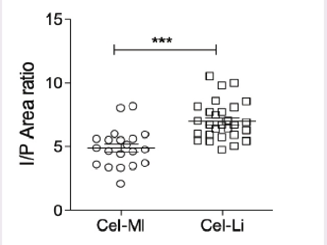 Correlation analysis of Iris/pupil (I/P) area ratio with age (Years) of