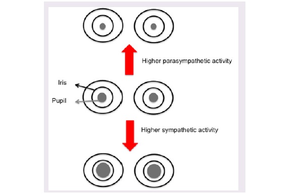 A schematic representing the effect of autonomic system activity on pupil diameter.