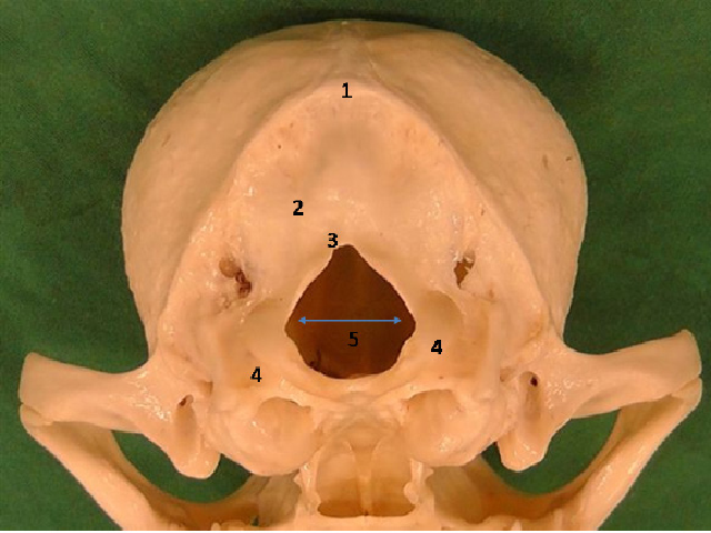 Caudal view of skull of Chihuahua dog